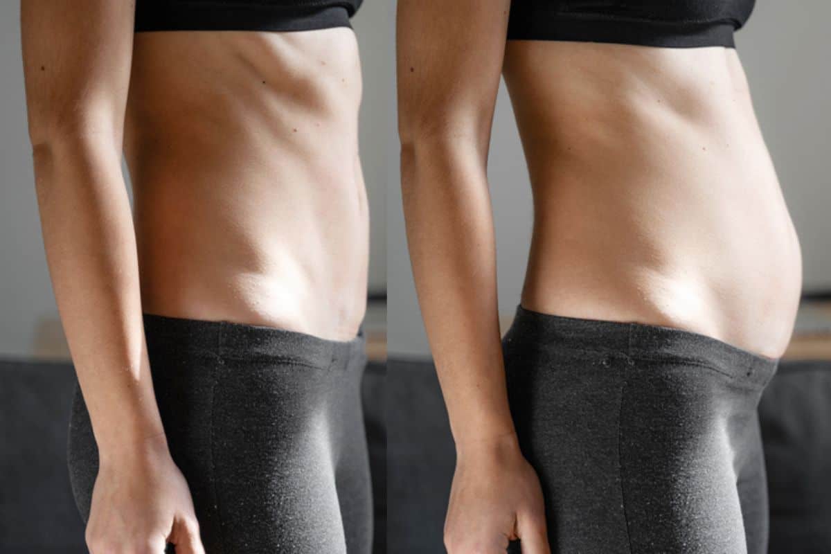 How long does diastasis recti take to improve Kenilworth?