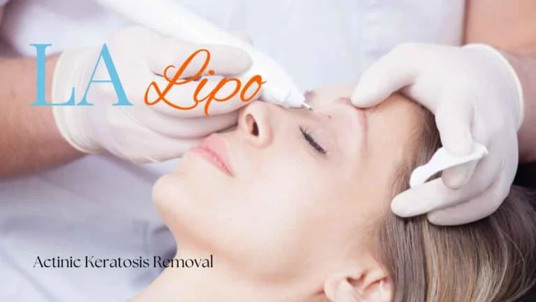 Woman receiving Actinic Keratosis Removal Treatment Kenilworth