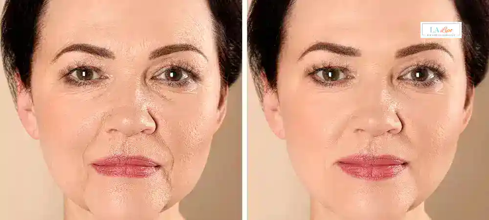 How Long Does It Take to See Results and How Long Do They Last Kenilworth?
