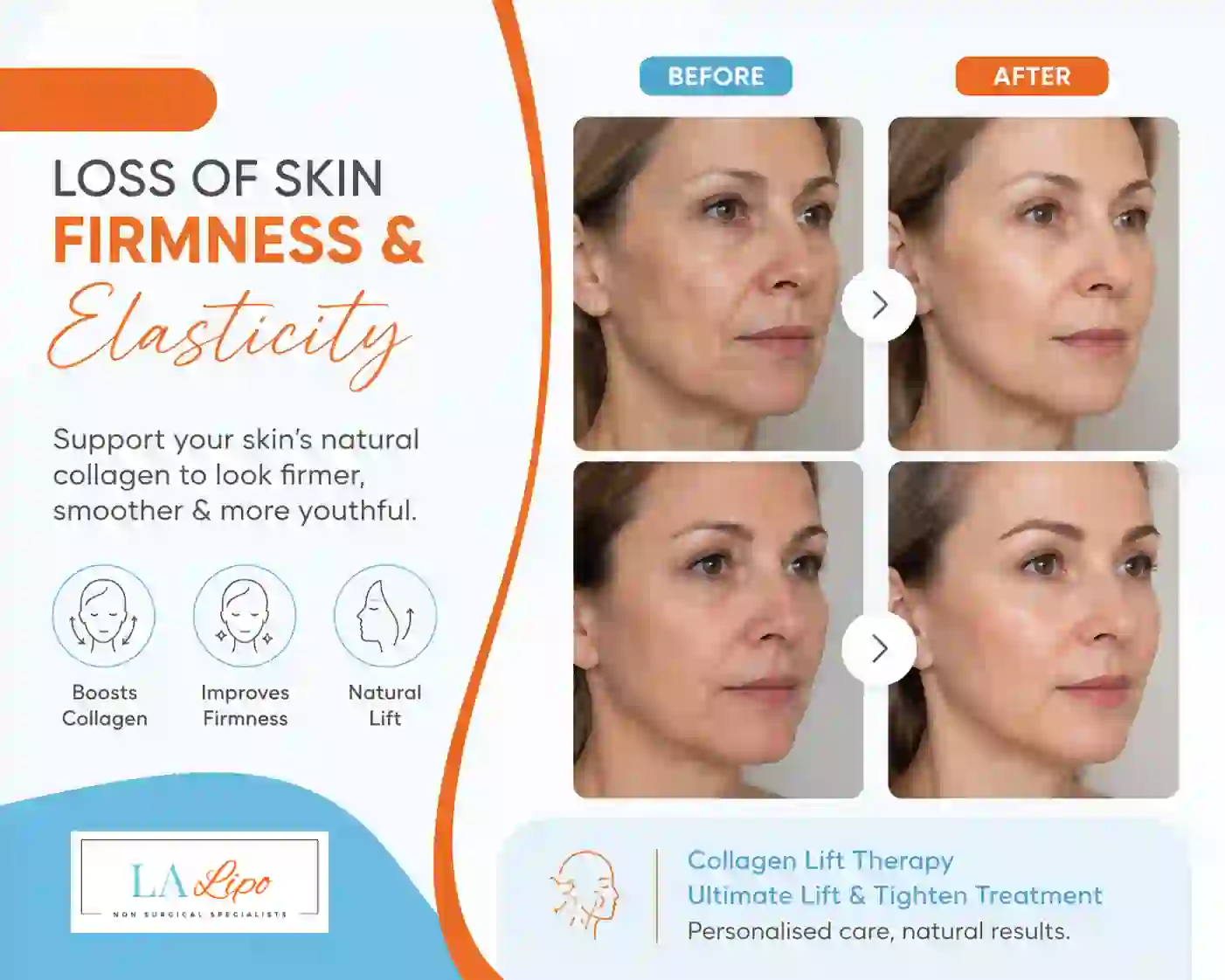 Sign #7: Loss of Skin Firmness and Elasticity Kenilworth